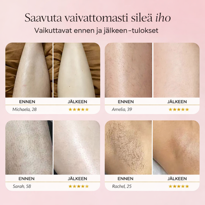Sōrave sähköinen tarkkuustrimmeri